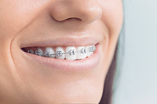 Best Dental Fillings (Composite and Amalgam)  in Meadowdale, WA